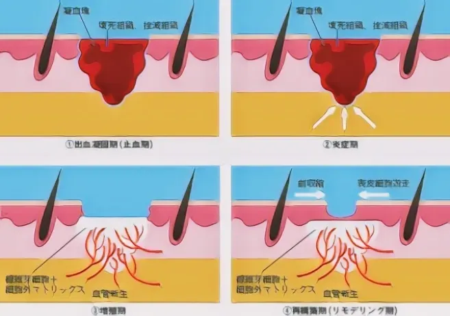 負傷治療過程